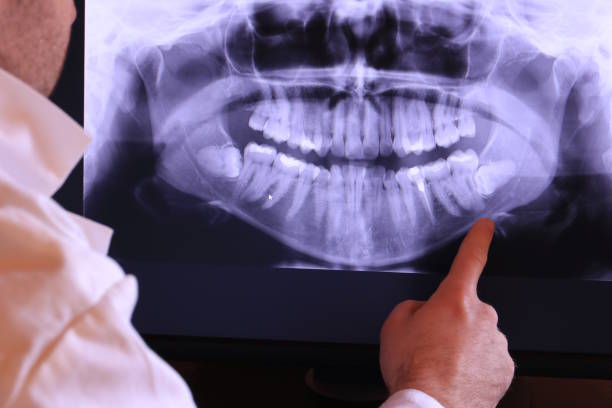 Teeth Whitening in KS