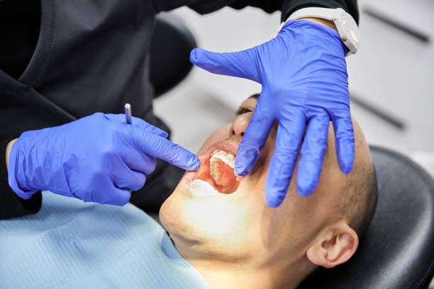 Best Emergency Dental Filling Replacement  in Horton, KS